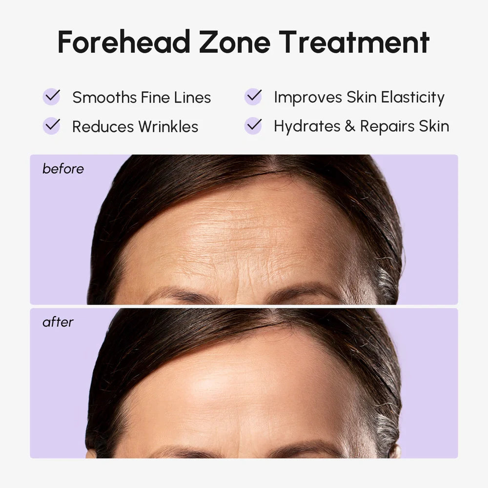 Marée Forehead Wrinkle Patches